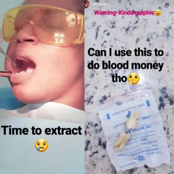 "Can I Use My Tooth For Blood Money?" - BBNaija